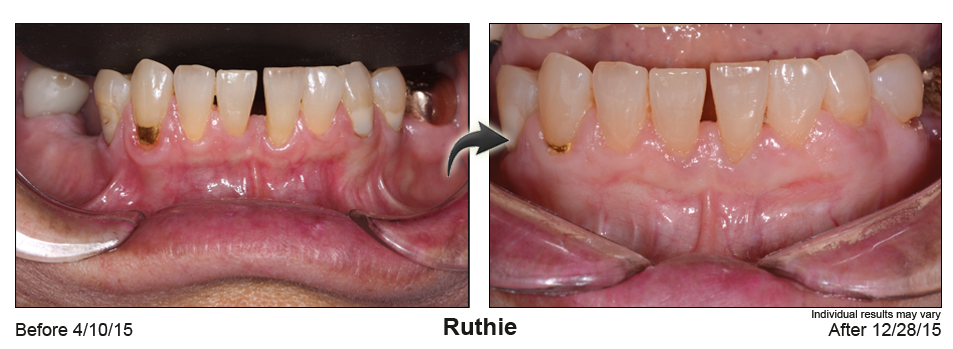 pst dentist Glendale